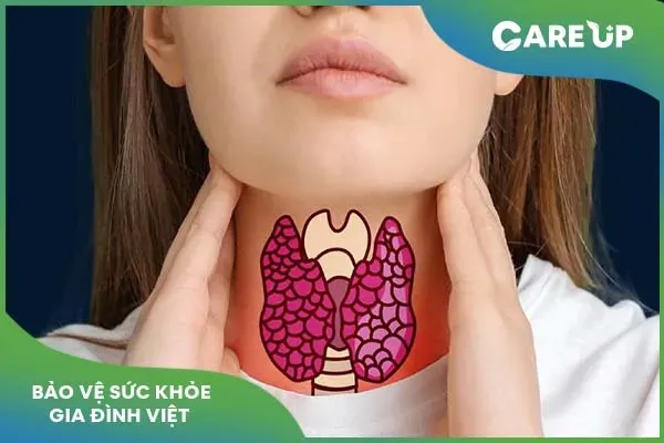 8 Vấn đề cần biết về thuốc Thyrozol: Tư vấn chi tiết cho bạn