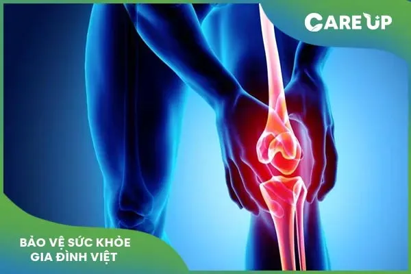 Glucosamine giúp cải thiện sức khỏe xương khớp