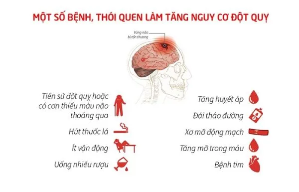 Gợi ý 9 cách phòng ngừa đột quỵ hiệu quả ngay tại nhà