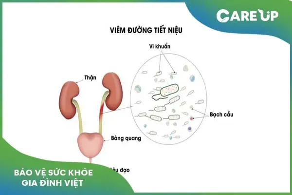 Lưu ý khi dùng thuốc Midasol điều trị một số bệnh lý tiết niệu