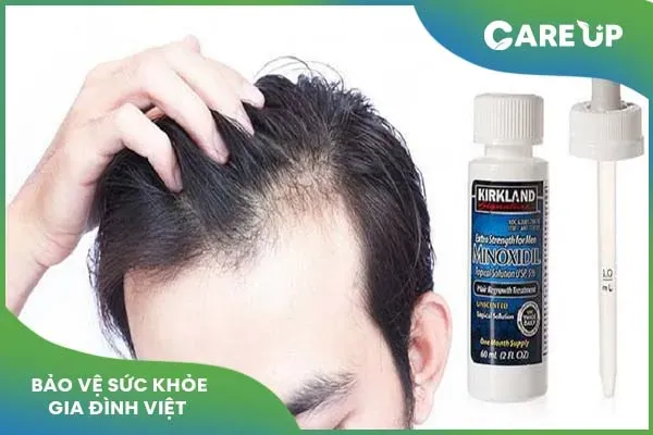 Sử dụng Minoxidil đúng cách để đạt hiệu quả tốt nhất