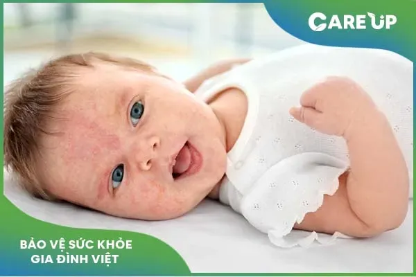 Thông tin sữa pediasure: Ưu điểm và những lưu ý khi sử dụng