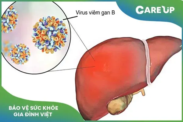 Thuốc Tenofovir điều trị viêm gan B mạn tính: Cách dùng và lưu ý