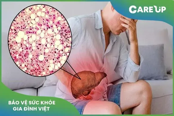 Thuốc VG5: Công dụng, liều dùng và lưu ý cần biết