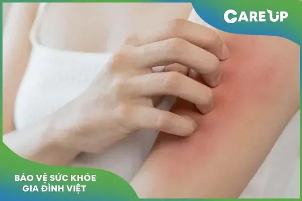 Tìm hiểu công dụng và cách sử dụng thuốc Promethazin hiệu quả