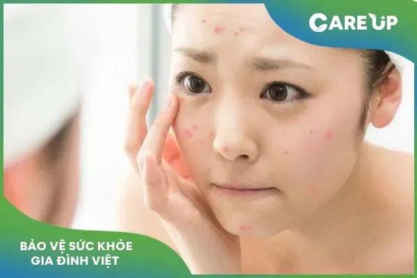 Tìm hiểu tác động của Niacinamide đến làn da