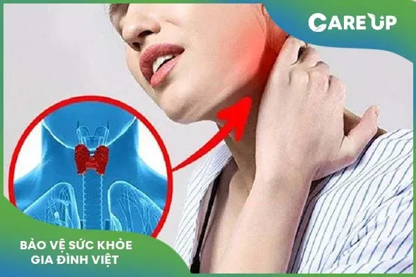 Tìm hiểu về thuốc tuyến giáp giúp điều trị viêm tuyến giáp