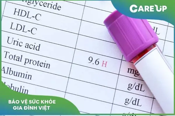 Tình trạng Acid Uric cao và những lưu ý phòng tránh