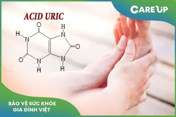 Tình trạng Acid Uric cao và những lưu ý phòng tránh