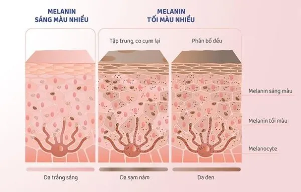 Top 5 phương pháp giảm hình thành Melanin phổ biến hiện nay 