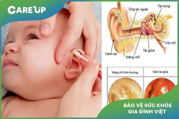 Giải đáp có nên tự điều trị bệnh viêm tai giữa cho trẻ không