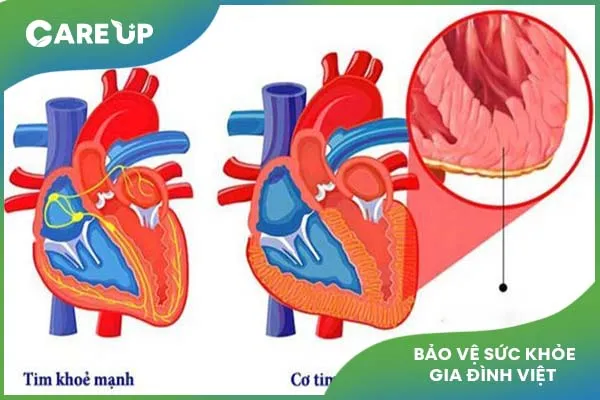 Trẻ nhỏ bị sốt siêu vi có nguy hiểm không?